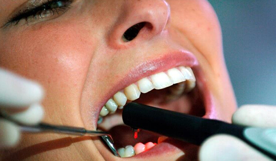 科学家利用激光使牙齿重生对临床医学影响巨大